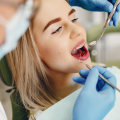 Why You Should Visit the Dentist Every 6 Months: The Benefits of Regular Checkups