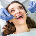 Special Considerations for People with Braces' Dental Care: A Guide to Maintaining Oral Health