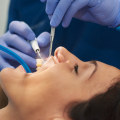 A Comprehensive Guide to Common Dental Procedures