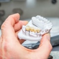 Everything You Need to Know About Dental Bridges