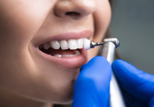The Consequences of Neglecting Your Oral Health