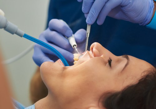 A Comprehensive Guide to Common Dental Procedures